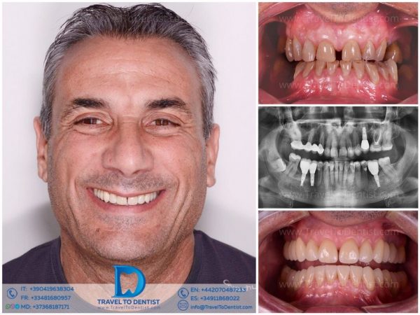 Caso 2 — Resultado dental